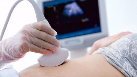 Las mujeres con embarazos complicados tienen el doble de riesgo de sufrir ictus o infartos