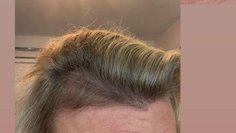 ‘Miracle cure’ hair growth supplement makes ‘unbelievable difference’ to its thickness