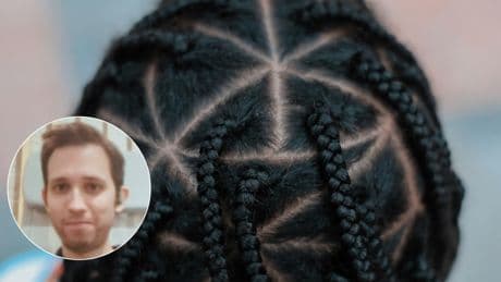 Óscar Muñoz, tricólogo: “Las trenzas apretadas pueden causar alopecia irreversible, incluso tras solo unos días de tensión extrema”