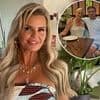 Kerry Katona reveals she developed alopecia after her stressful split from ex Ryan Mahoney and admits she still struggles with hair loss