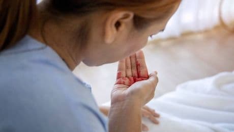 People who keep coughing warned it could be painful and fatal condition