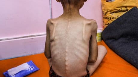 « J’ai vu des enfants qui meurent de faim » : à Gaza, la famine atteint un « point de rupture », alerte l’ONU