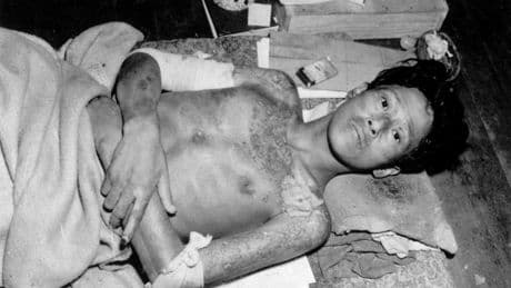 80 yıl sonra Nagasaki’den çağrı: Nükleer felaket kapıda