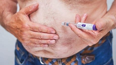 Who is eligible for Mounjaro as weight loss jab becomes available from GPs?