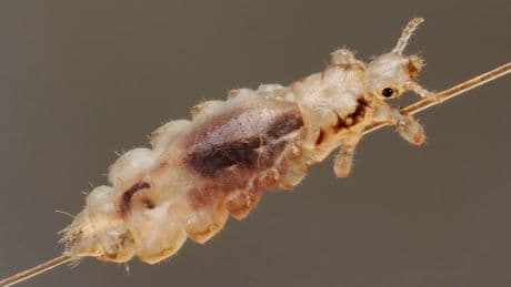 So THAT's The Difference Between Nits And Head Lice