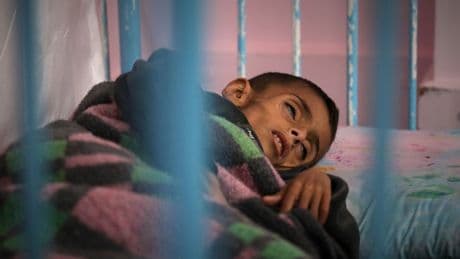 Hunger and malnutrition are rising across Gaza as Israel's blockade leaves mothers with few options