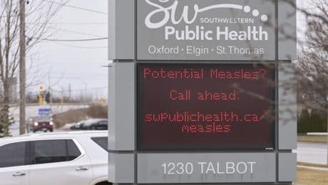 Measles circulating in northeastern B.C. community, health officials warn