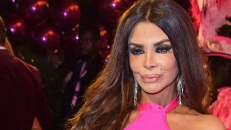 So sah Kader Loth mit 24 Jahren vor ihren Beauty-OPs aus