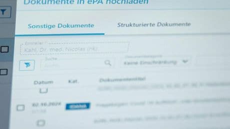 Digitalisierung: Lauterbach bestätigt Sicherheitslücke bei E-Patientenakte