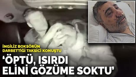 İngiliz boksörün darbettiği taksici konuştu: Öptü, ısırdı, elini gözüme soktu