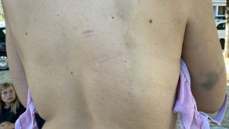 Percossi per aver bloccato mattatoi: quel giorno gli attivisti hanno spezzato una routine di morte