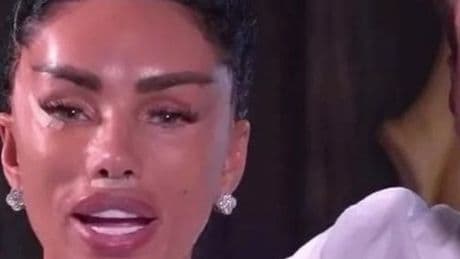Katie Price pulls facelift stitches out in sickening mistake