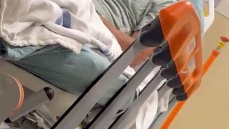 Orioles announcer Ben McDonald hospitalized after falling 25 feet from deer stand