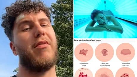 Man diagnosed with skin cancer at just 26 reveals the telling sign he had the disease... which he almost overlooked
