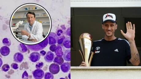 Leucemia mieloide, cosa c'è dietro l'aumento di pazienti. L'oncologo: «Farmaco riduce la mortalità del 97%». Sopravvivenza ed effetti collaterali