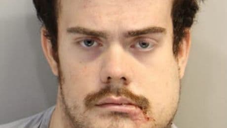 Florida State University alleged mass shooter appears in mugshot with disfigured face after hospital release