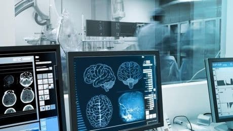 Menschliche Hirnzellen: Erstmals steuern sie einen Computer