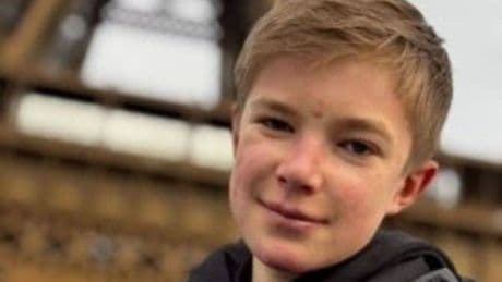 Boy, 12, whose skin tears at the slightest touch given hope after groundbreaking trial