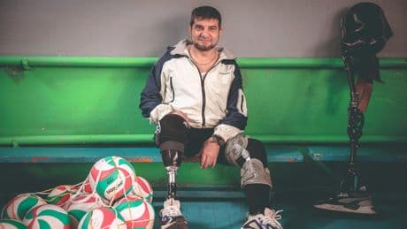 50.000 amputés depuis 2022: en Ukraine, la difficile reconstruction des «gueules cassées»