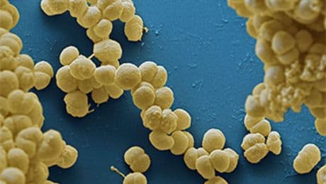 ‘Get jabbed’ health chiefs warn after flu-like disease that kills in 24 hours found in travellers returning to the UK