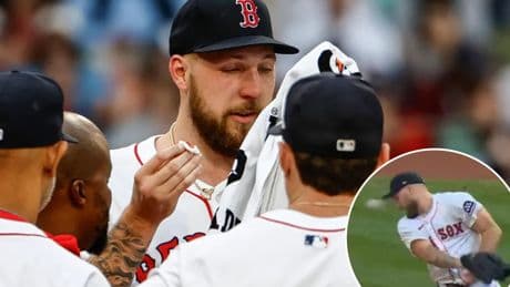 Red Sox’s Garrett Crochet takes comebacker off nose — and stays in the game