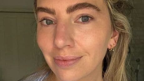‘This brightening vitamin C serum is the only one that doesn’t irritate my problem skin’