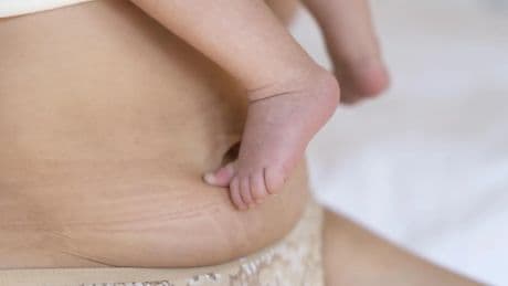 Un hospital italiano pagará 1,5 millones por no vigilar a una madre que aplastó a su hijo mientras daba el pecho