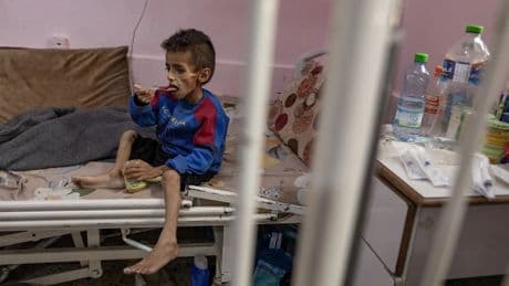 Nach Debatte um Foto: Kind aus Gaza aus Krankenhaus in Italien entlassen