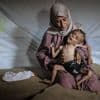Schokkende foto’s van graatmagere Muhammad laten realiteit in Gaza zien: Bijna 5000 kinderen ondervoed