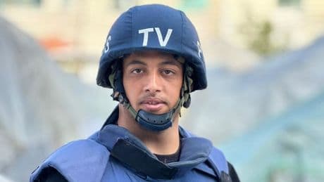 Victims of Gaza hospital bombing race against time for lifesaving treatment abroad