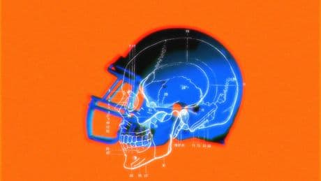 Why it’s so hard to make a ‘safer’ football helmet