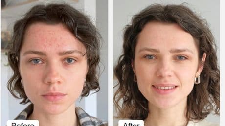 LED face mask that 'transforms skincare routine' is £150 off with exclusive code