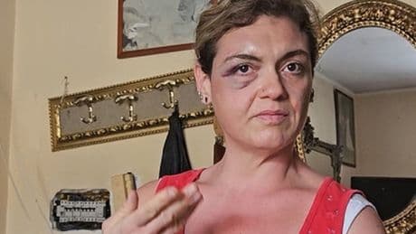 La casa occupata con violenza a Napoli: «Ci hanno preso a sprangate, ma l'abbiamo difesa»