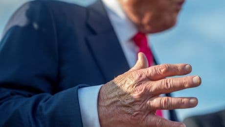 Liveblog USA unter Trump: Weißes Haus: Trump hat chronische Erkrankung der Beinvenen