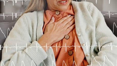 Blood thinner could be more effective than common drug at preventing heart attacks