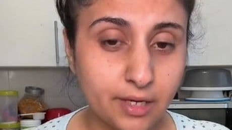 'I lost 4st on weight loss drug Mounjaro - but it's ruined my life after severe side effects'