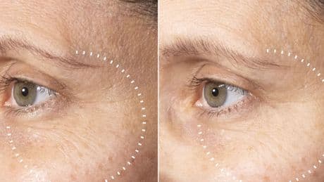 Medik8 fans say new vitamin C serum gives a 'visible glow' in one week