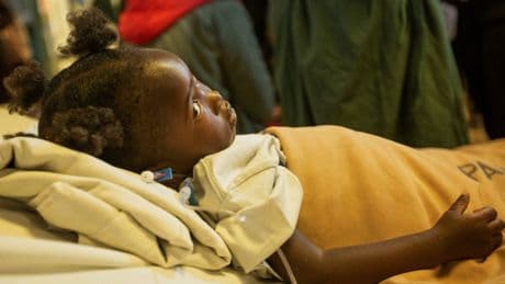 For some Zimbabwe children with heart disease, a rare lifeline restores hope