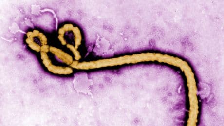 Nach Afrika-Reise: Mann mit Verdacht auf Ebola auf Intensivstation in Tschechien