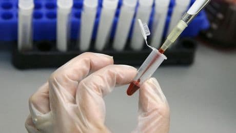 Investigadores vascos desarrollan una herramienta para la detección temprana de enfermedades