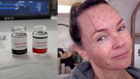 People self-injecting themselves with black market 'Korean Botox' given grave warning by experts