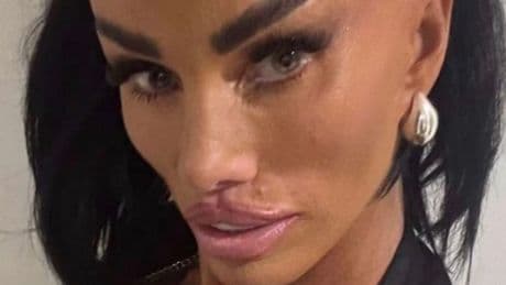 Katie Price's face looks more stretched than ever as she poses for painful selfie