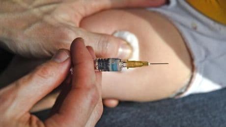 Bronchiolite : une vaste étude confirme l’efficacité du Beyfortus contre les infections graves