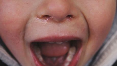 I'm A Therapist – Say This 1 Thing To Your Kid If They Bite Another Child