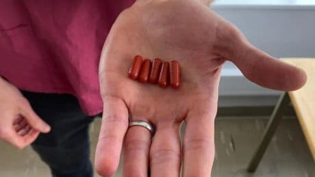 Artsen testen opmerkelijke behandeling: ’poeppillen’ met ontlasting van donoren moeten superbacteriën verdrijven