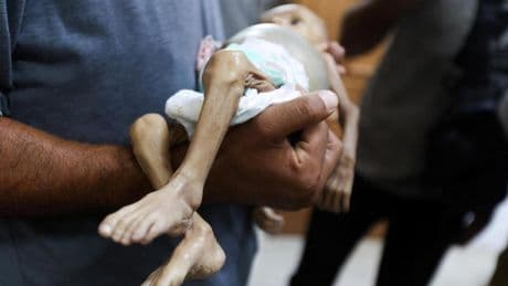 Israel permitirá la entrada de ayuda humanitaria en Gaza después de la muerte de 124 palestinos por desnutrición