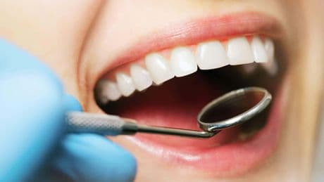What are 'Ozempic teeth'? Exploring new side effect of weight-loss drug