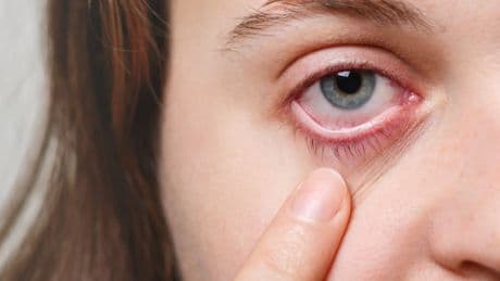 El síndrome diagnosticado poco que reduce la calidad de vida como una angina de pecho y afecta a las mujeres