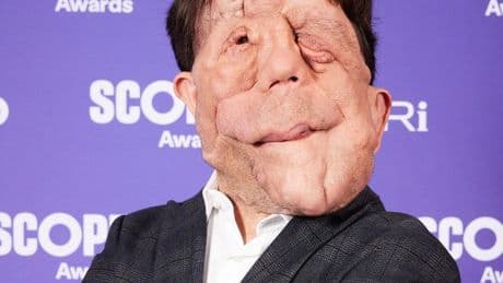 Chris McCausland says Scope Awards show how disabled community ‘really are capable of so much more than others might think’