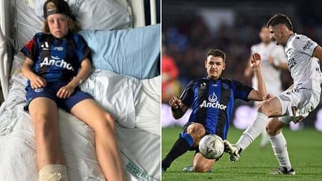 See the shocking injury boy, 11, suffered when he was IMPALED on a metal pole while celebrating his brother's birthday at footy final
